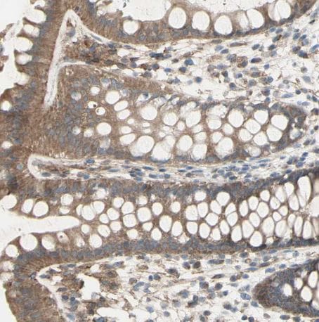 IGSF9B Antibody