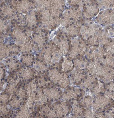 FAM83H Antibody
