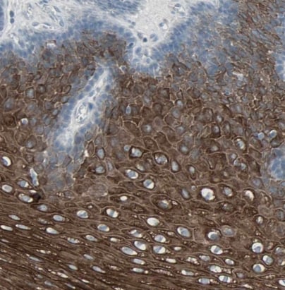 LANCL3 Antibody