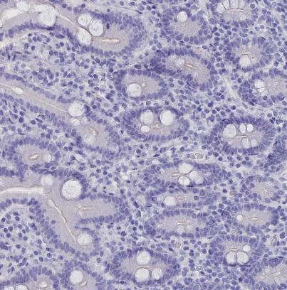 CLEC2L Antibody