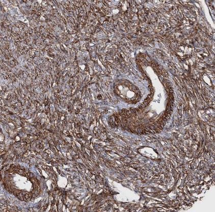 TMEM164 Antibody