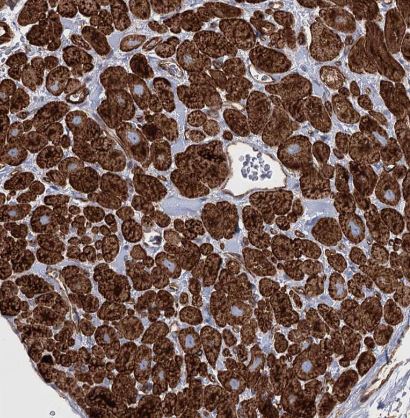 TMEM164 Antibody
