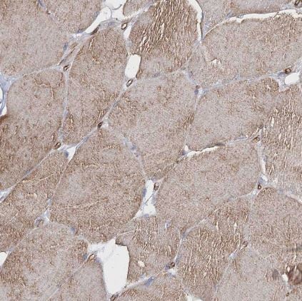TMEM164 Antibody