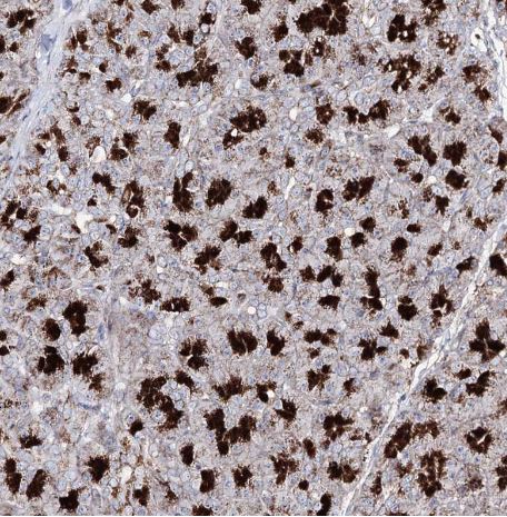 TOP6BL Antibody
