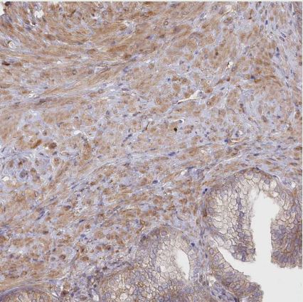 SH3PXD2B Antibody
