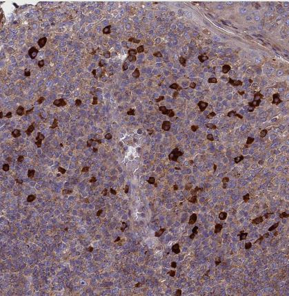 MIOS Antibody