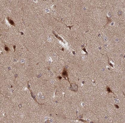 INO80D Antibody