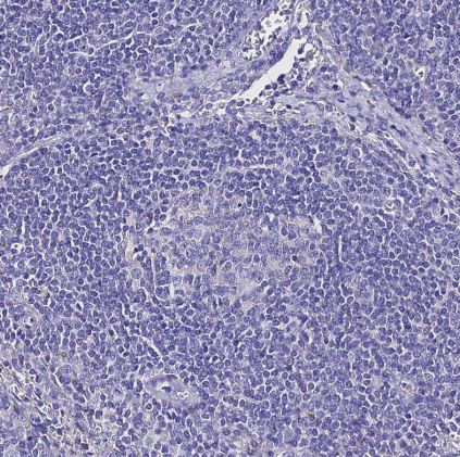 TMEM117 Antibody