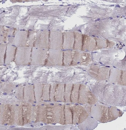 UGT2A1 Antibody - BSA Free