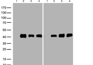 LPAR1/LPA1/EDG-2 Antibody (OTI1G6)