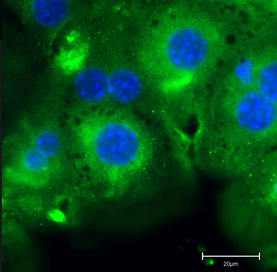 ERp72 Antibody (OTI2B9)