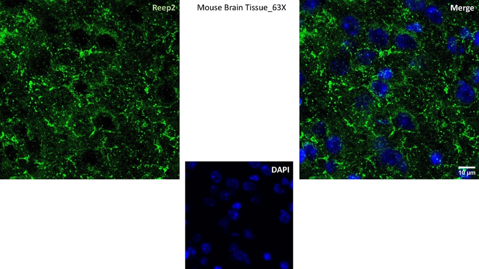 REEP2 Antibody (OTI2C7)