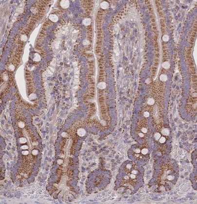 SLC25A42 Antibody - BSA Free