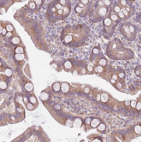Snx6 Antibody