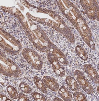TIMM13 Antibody