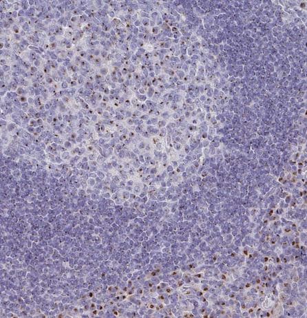 VKORC1L1 Antibody