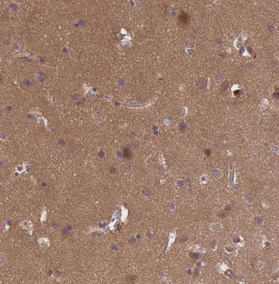 Puromycin-sensitive aminopeptidase/NPEPPS Antibody