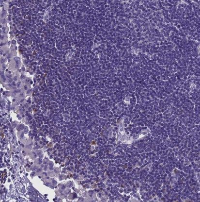PLCXD3 Antibody
