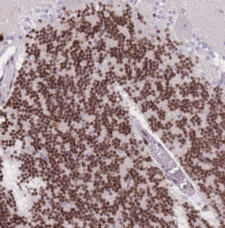 PSMB5 Antibody