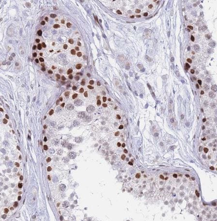 PSMB5 Antibody