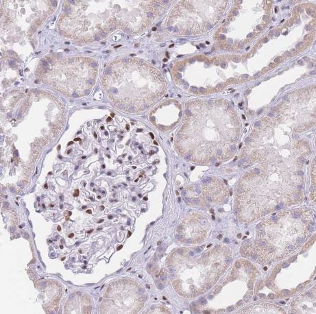 PSMB5 Antibody