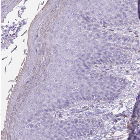 PSMB5 Antibody