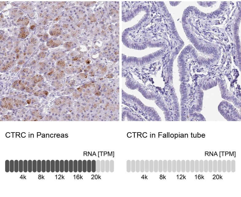 Chymotrypsin C/CTRC Antibody - BSA Free