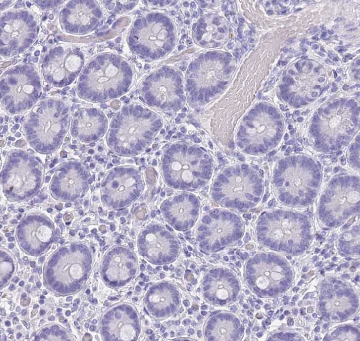 Chymotrypsin C/CTRC Antibody - BSA Free