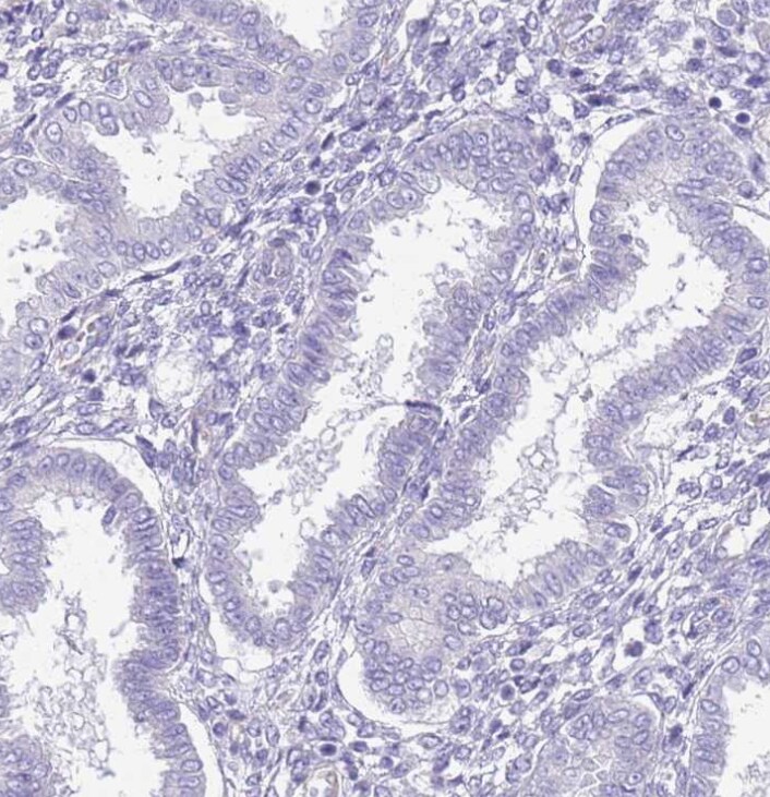 Chymotrypsin C/CTRC Antibody - BSA Free