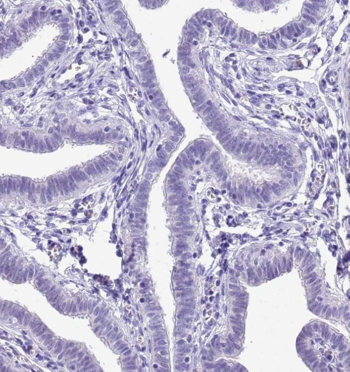 Chymotrypsin C/CTRC Antibody - BSA Free
