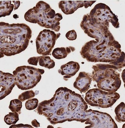 DENR Antibody
