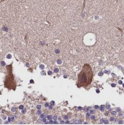 DENR Antibody