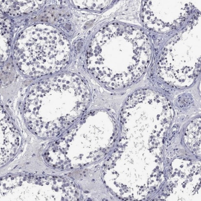 5-HT4 Antibody - BSA Free