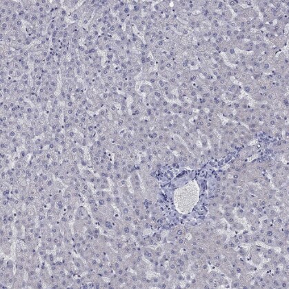 5-HT4 Antibody - BSA Free