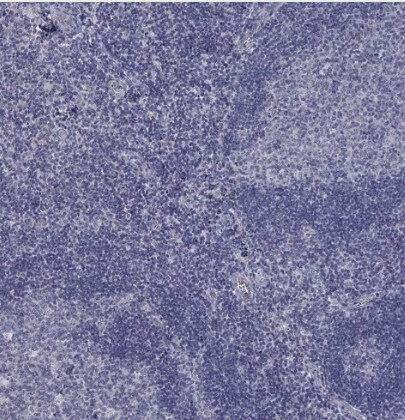 5-HT4 Antibody - BSA Free