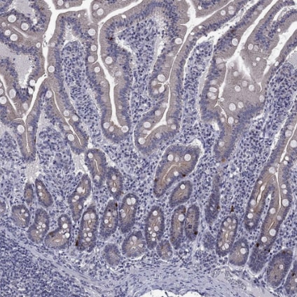 5-HT4 Antibody - BSA Free
