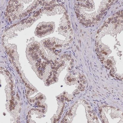 KLHDC2 Antibody