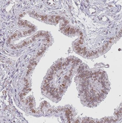KLHDC2 Antibody
