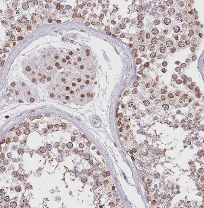 KLHDC2 Antibody