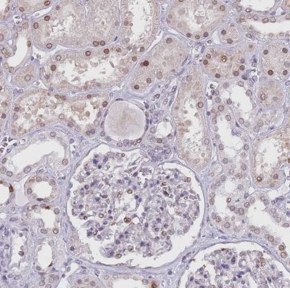 KLHDC2 Antibody