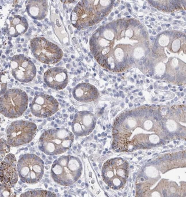 LCLAT1 Antibody - BSA Free