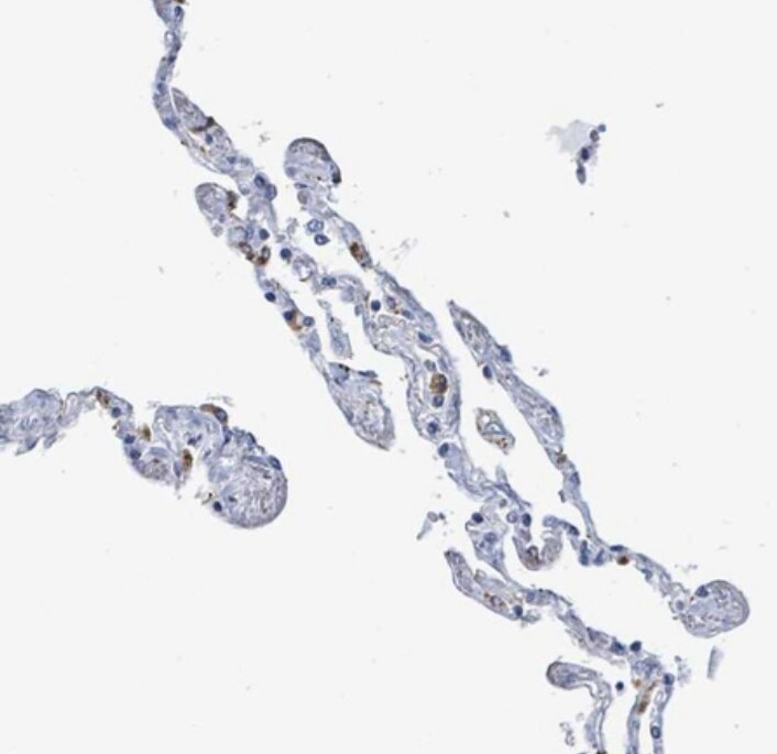 LCLAT1 Antibody - BSA Free