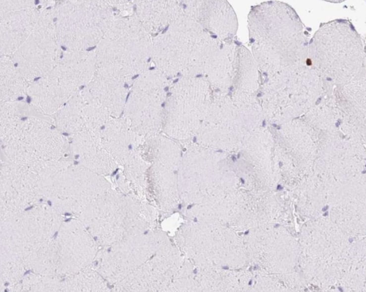 LCLAT1 Antibody - BSA Free