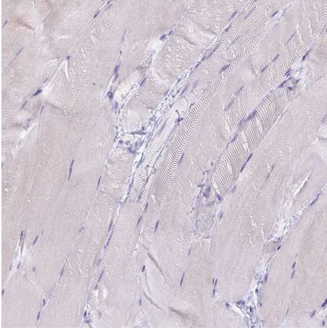 Bradykinin RB2/BDKRB2 Antibody