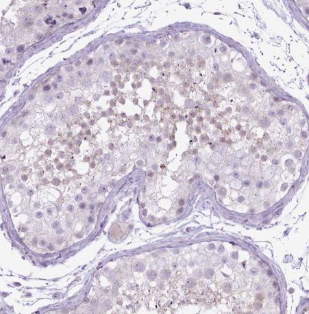 Bradykinin RB2/BDKRB2 Antibody
