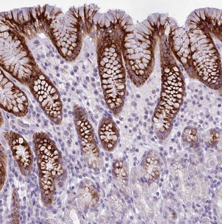 Bradykinin RB2/BDKRB2 Antibody