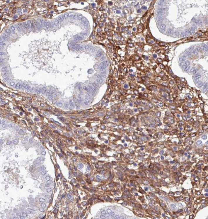 Endosialin/CD248/TEM1 Antibody - BSA Free