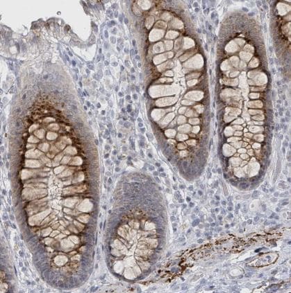 GPR15L Antibody