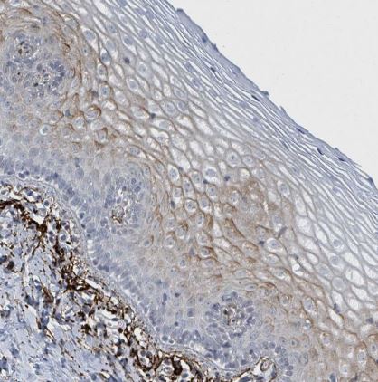 GPR15L Antibody
