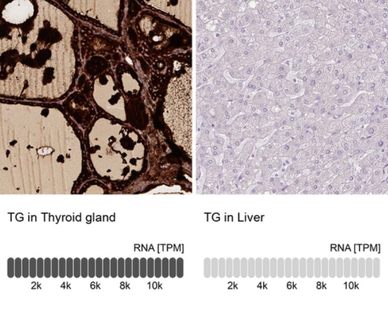 Thyroglobulin Antibody (CL0164) - BSA Free